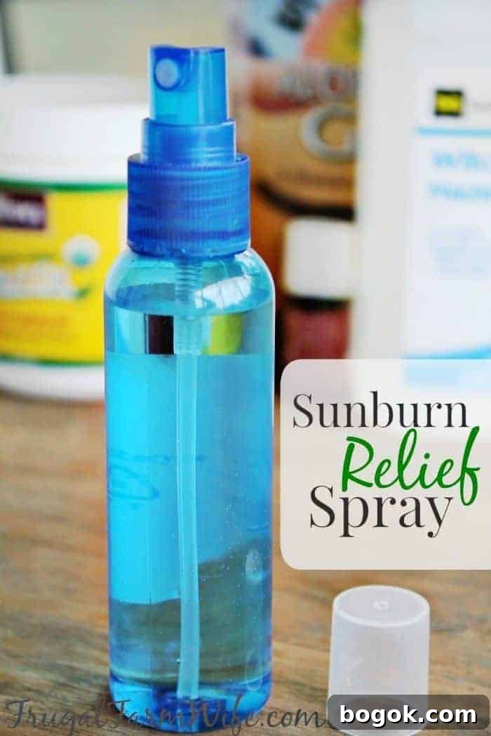 15 DIY Skincare Products You Can Make at Home to Cut Costs 12 Photo shows a small blue spray bottle with the words 'Sunburn Relief Spray'